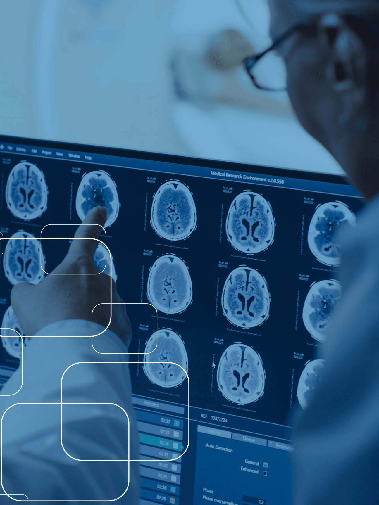Elo RDI — telerradiologia com inteligência artificial