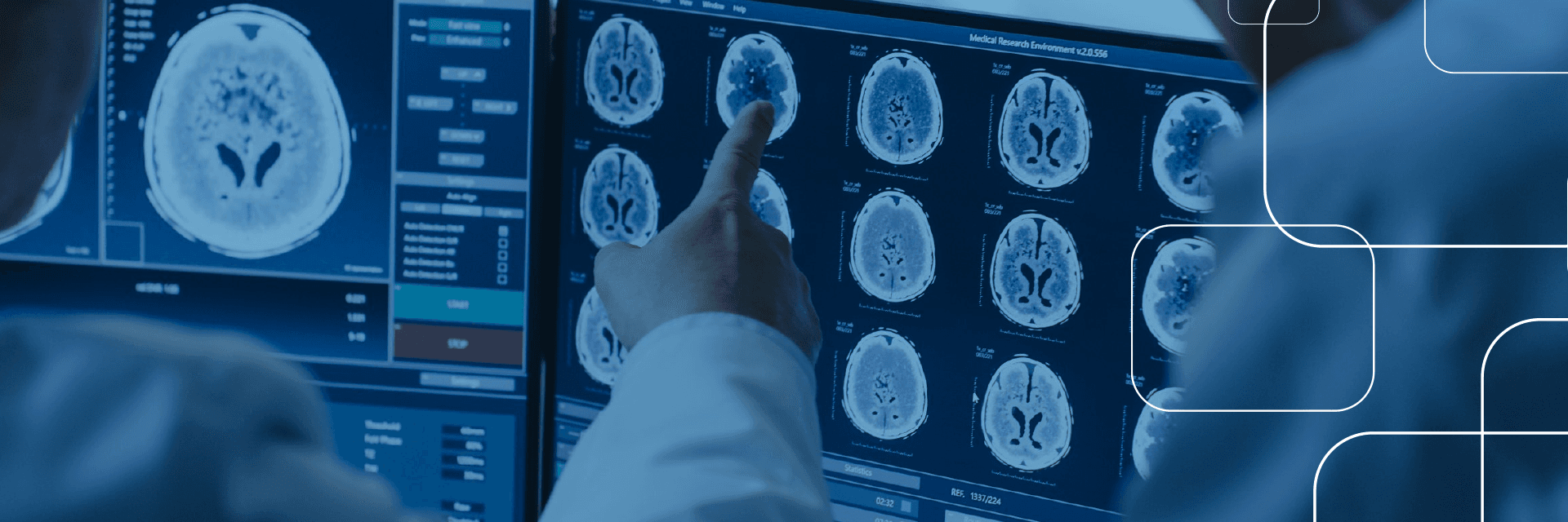Elo RDI — telerradiologia com inteligência artificial