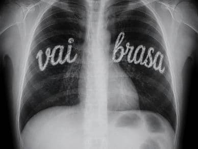 A pessoa certa no lugar certo: o que a escolha de uma marca de esportes pode ensinar sobre gestão de equipes na saúde